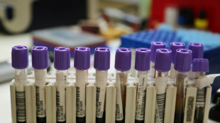 "Los niños están muriendo": la leptospirosis causa estragos entre los indígenas de Ecuador