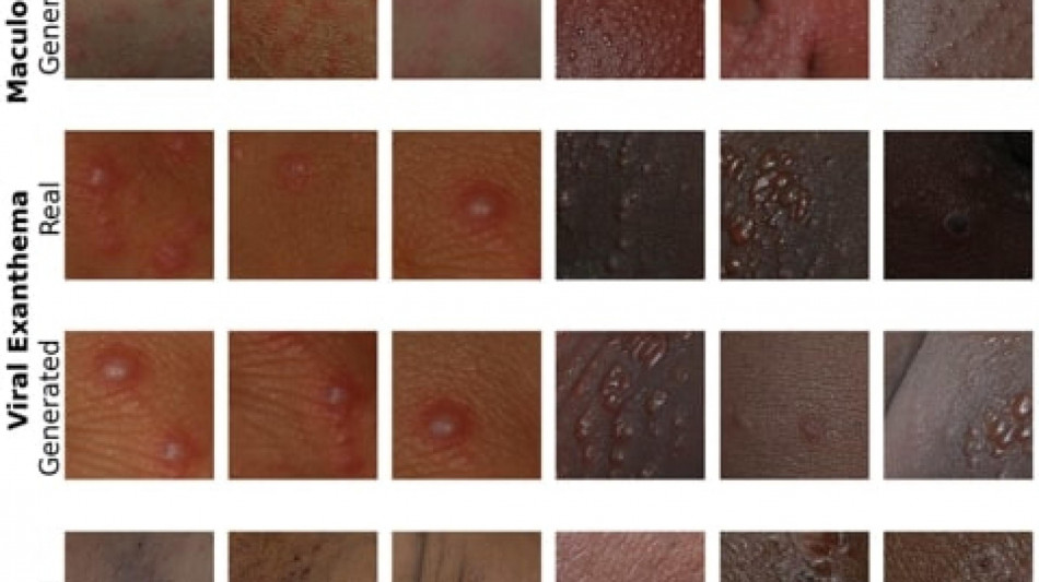 Malattie pelle, da UniBo Ai pi&ugrave; equa per diagnosi pi&ugrave; inclusiva