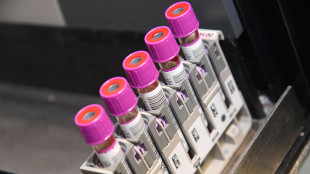 Il tumore del colon-retto ora &egrave; visibile dal sistema immunitario