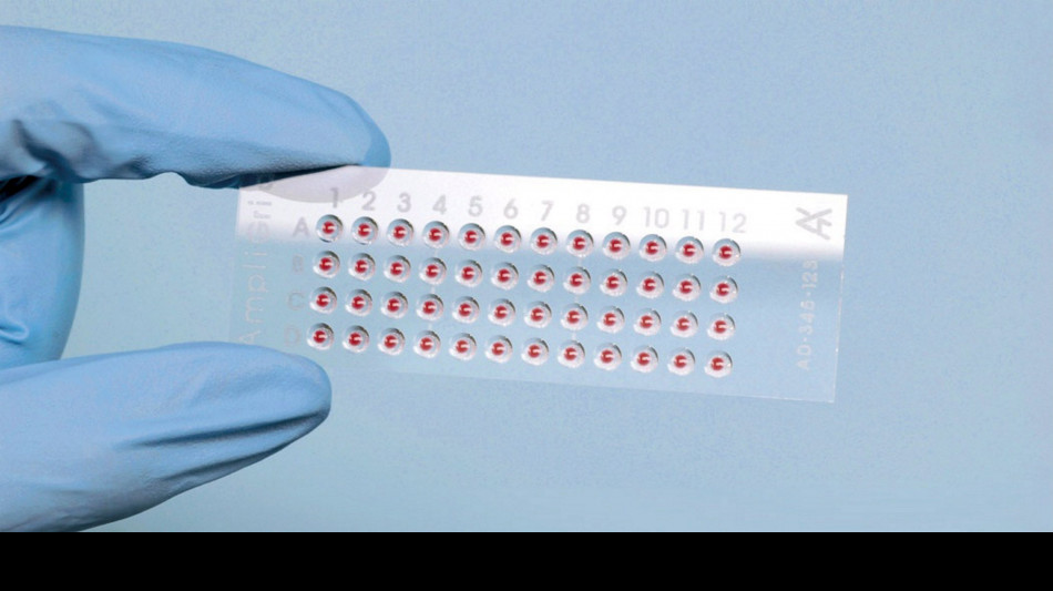 Oncologi, 'attivare subito test genomici per tumore al seno'