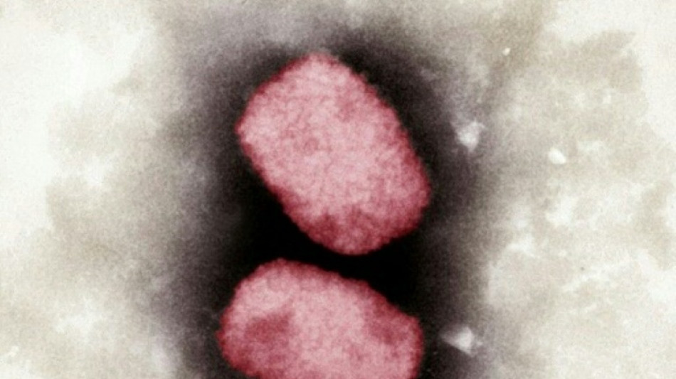 EU-Experten halten Risiko starker Ausbreitung der Affenpocken f&uuml;r "sehr gering"