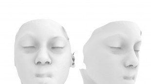 Ricostruiti da zero naso e labbro in 3D a bimbo morso da animale