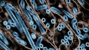 Grippe aviaire: r&eacute;apparition d'une souche transmissible &agrave; l'homme dans un &eacute;levage aux Etats-Unis