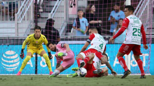 Messi exits early with injury in Miami's Leagues Cup win