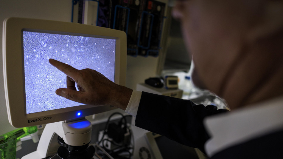 Tumori, in organoidi di muscoli la chiave contro il deperimento