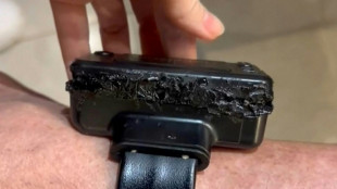 Besch&auml;digte Fu&szlig;fessel: Brasiliens Ex-Pr&auml;sident Bolsonaro wegen Fluchtgefahr inhaftiert