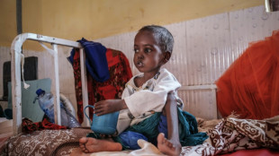 World hunger stops rising but remains elevated: UN