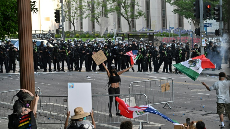 AFP photographer shot in face with rubber bullet at LA protest